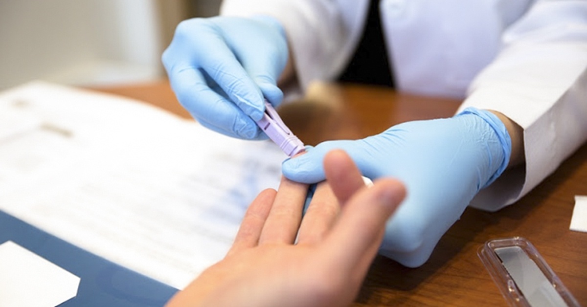Điều trị HIV/AIDS ảnh 7 Dieu tri HIV/AIDS anh 7