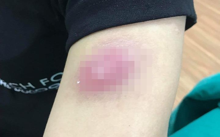 Tien mat, tat mang vi tiem tan mo o spa hinh anh