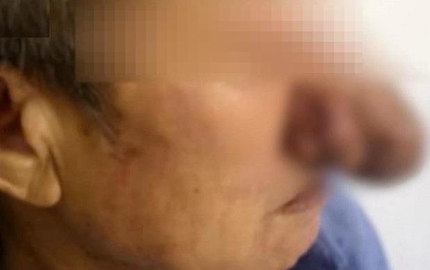 Mui dai ra nhu phu thuy vi nghien ruou suot 10 nam hinh anh