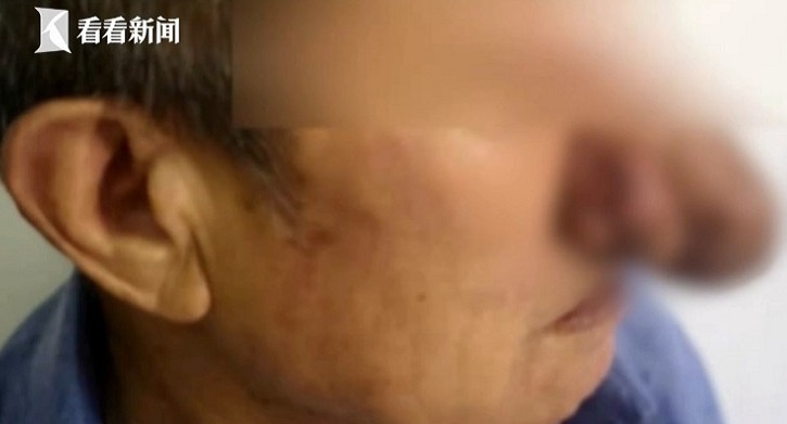 Mui dai ra vi say ruou lien tuc anh 1