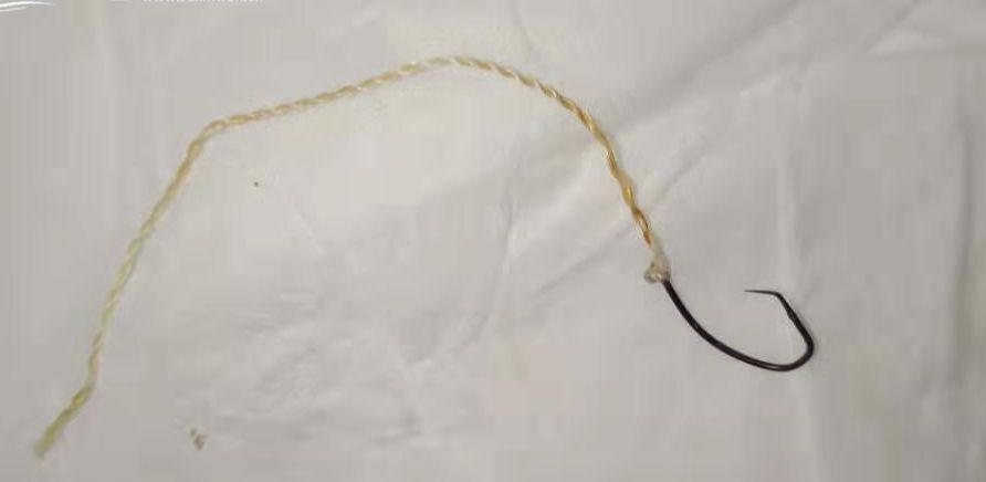 Chang trai phai cat 10 cm ruot non vi nuot moc cau khi an ca hinh anh