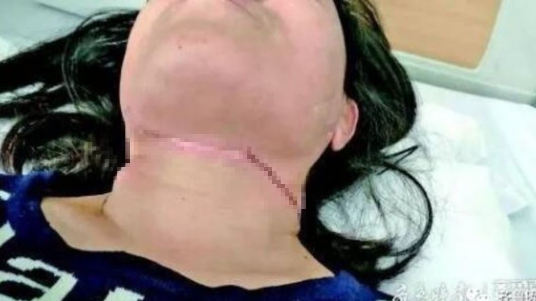 Đứt cổ vì dây diều khi đang đi xe máy ảnh 1 Dut co vi day dieu khi dang di xe may anh 1