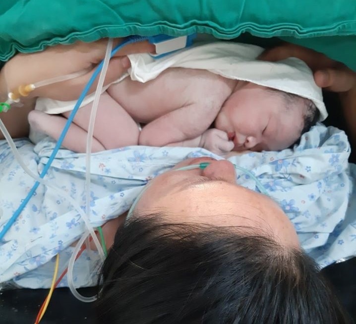 vua de mo vua cat khoi u xo lon anh 1