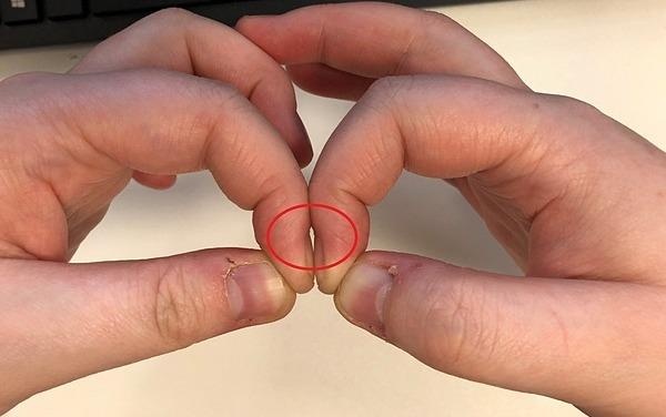 Cach don gian phat hien som ung thu phoi hinh anh