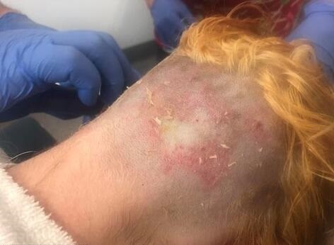 lột da đầu vì tẩy tóc ảnh 1 lot da dau vi tay toc anh 1