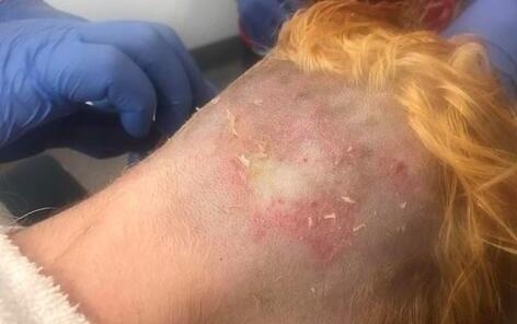 Tu tay mau toc, co gai bi lot da dau hinh anh