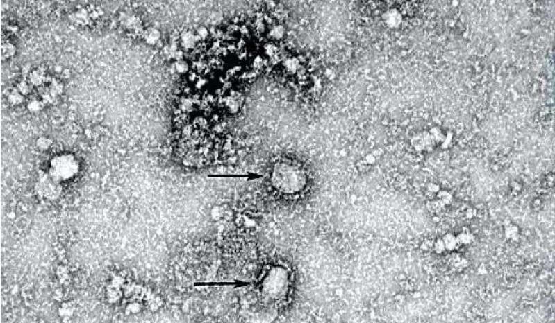 'Virus corona se bi tieu diet o moi truong tren 57 do C' hinh anh