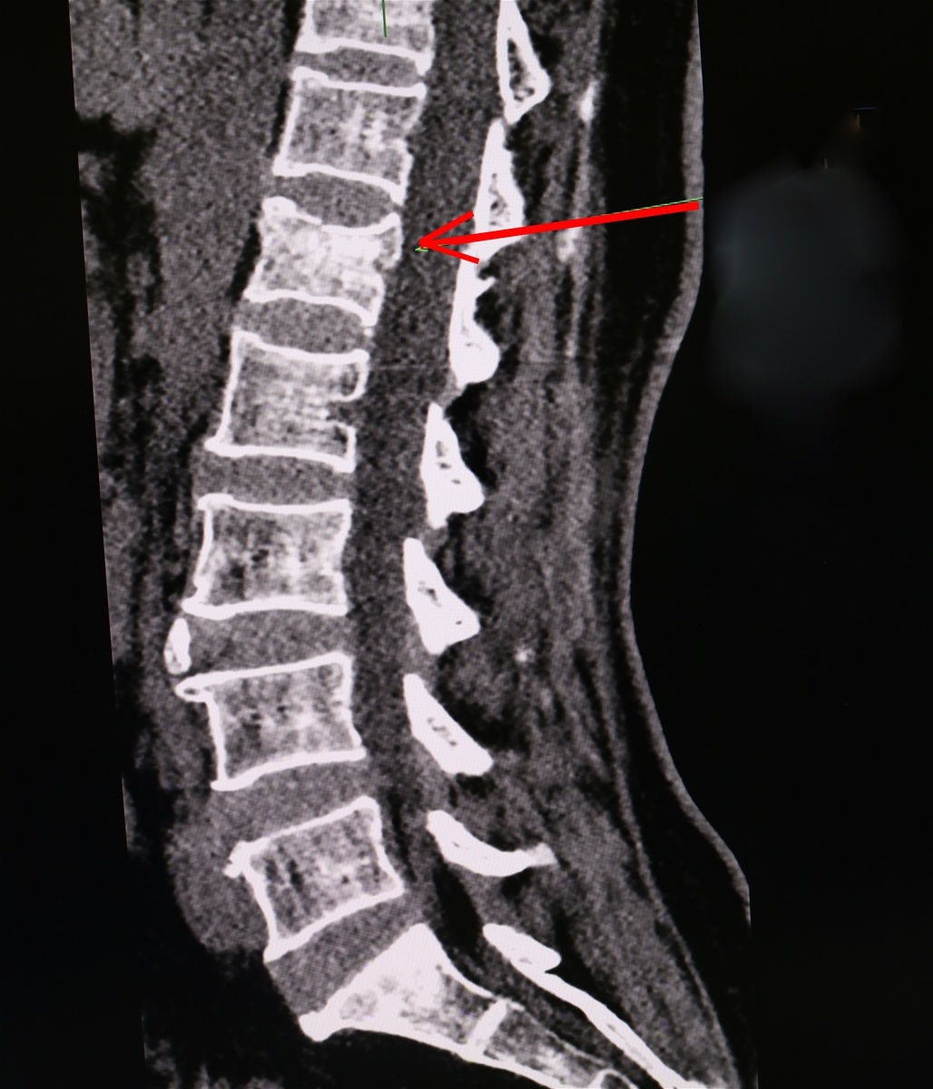 xep dot song do khan vuong banh xe may anh 1