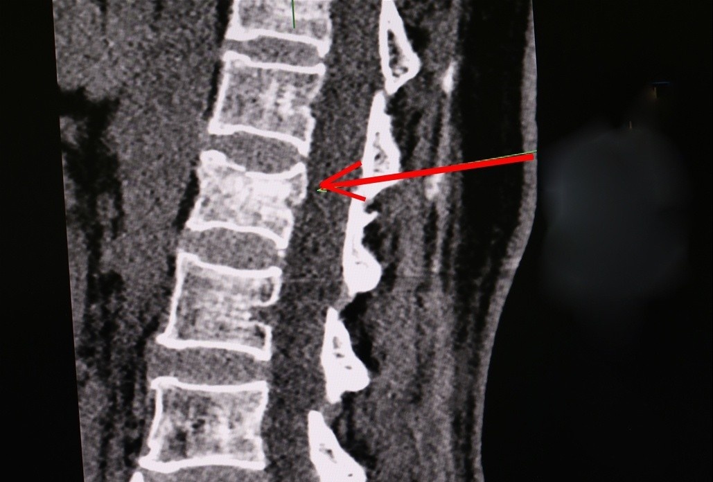 Khan vuong banh xe may, nguoi phu nu vo mam chay, xep dot song hinh anh