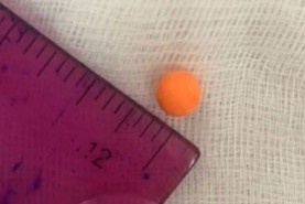 Be trai 3 tuoi bi hat mac ket trong mui hinh anh