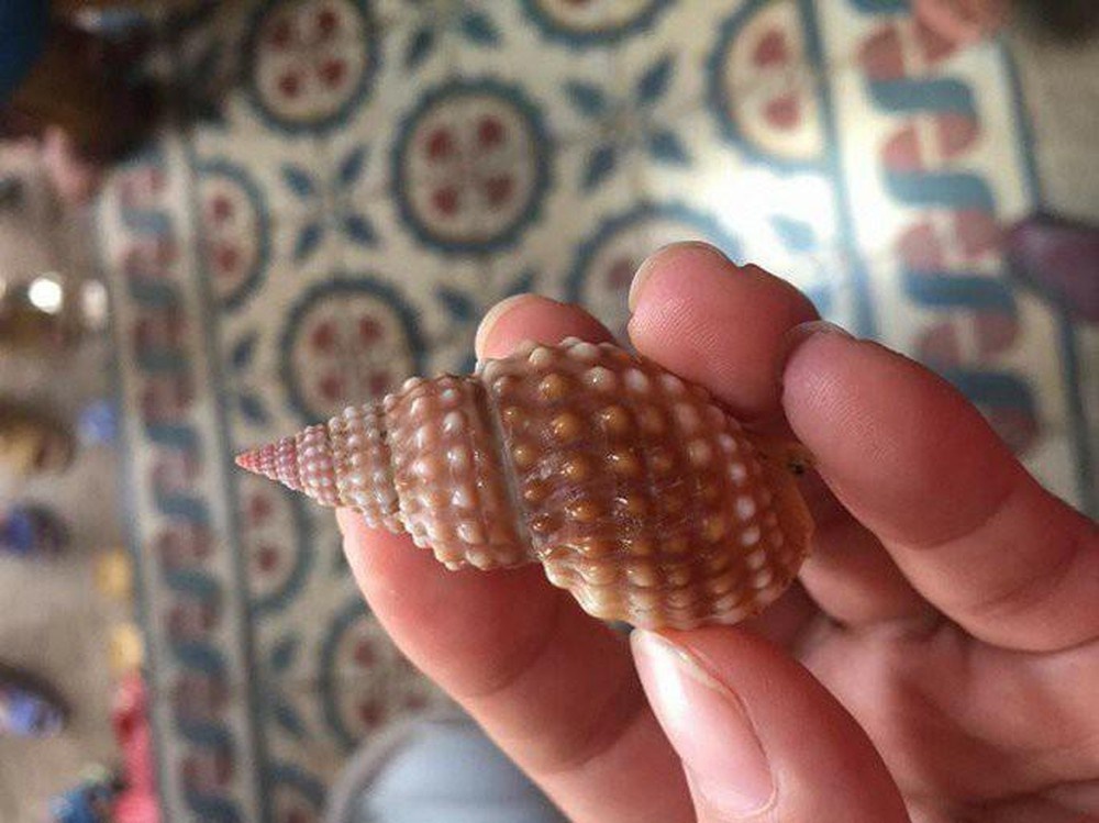 oc co the gay chet nguoi neu an phai anh 3