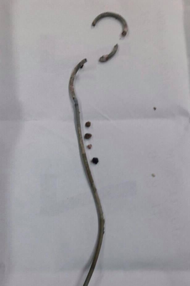 Bo quen ong thong trong nguoi 3 nam anh 1