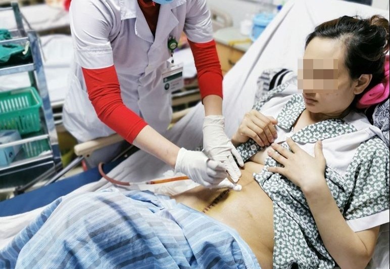 San phu suyt chet vi vo tu cung sau sinh hinh anh