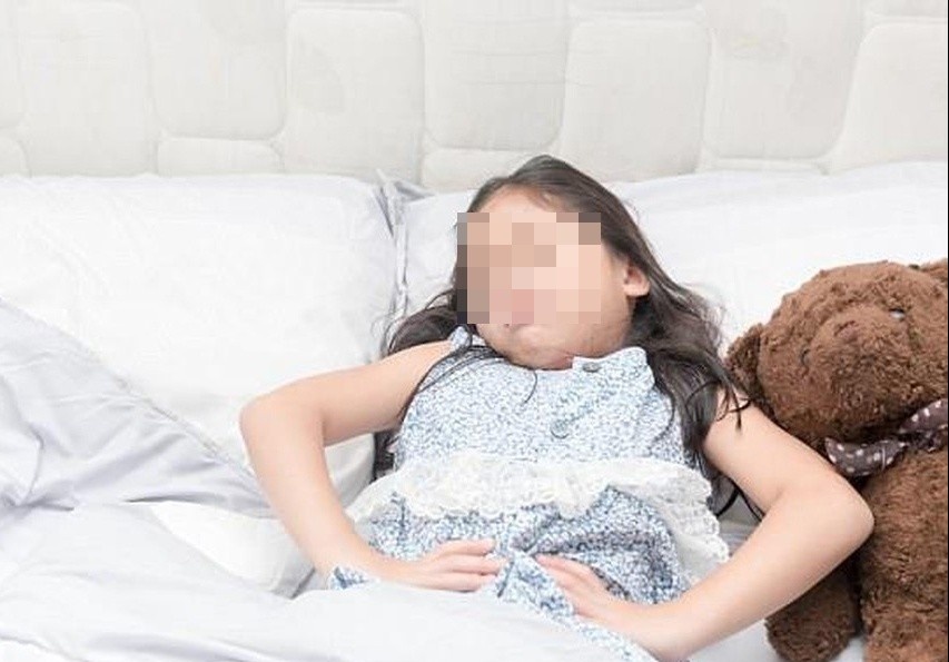 Nhap vien vi rach tang sinh mon, benh nhi duoc phat hien di tat o tim hinh anh