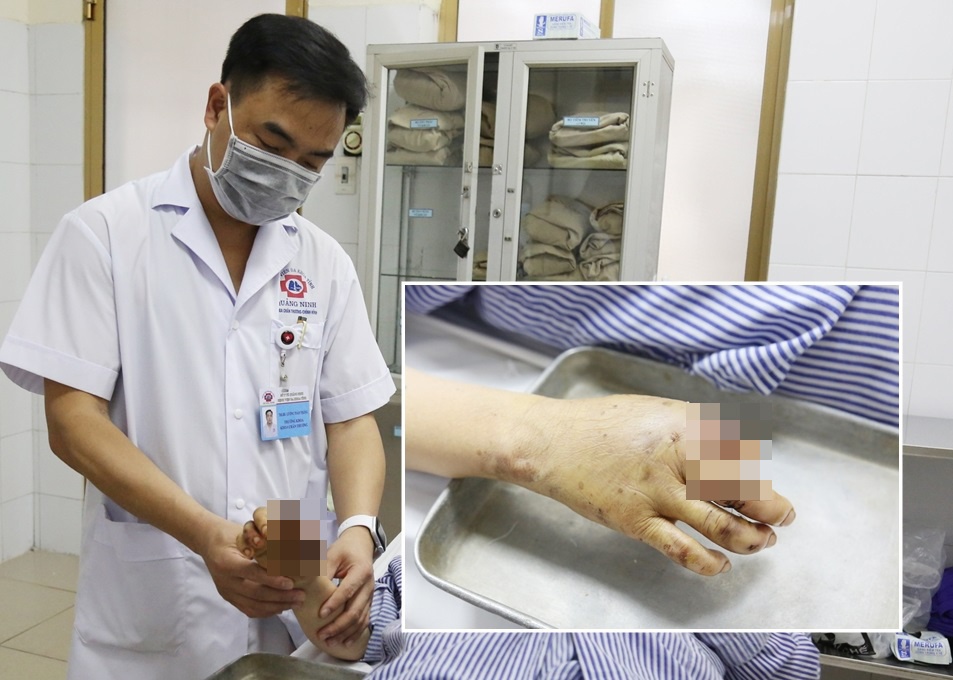 May xay thit nghien nat ban tay anh 1