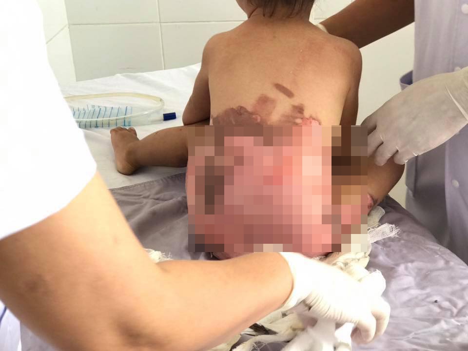 Nga vao chau nuoc soi anh 1