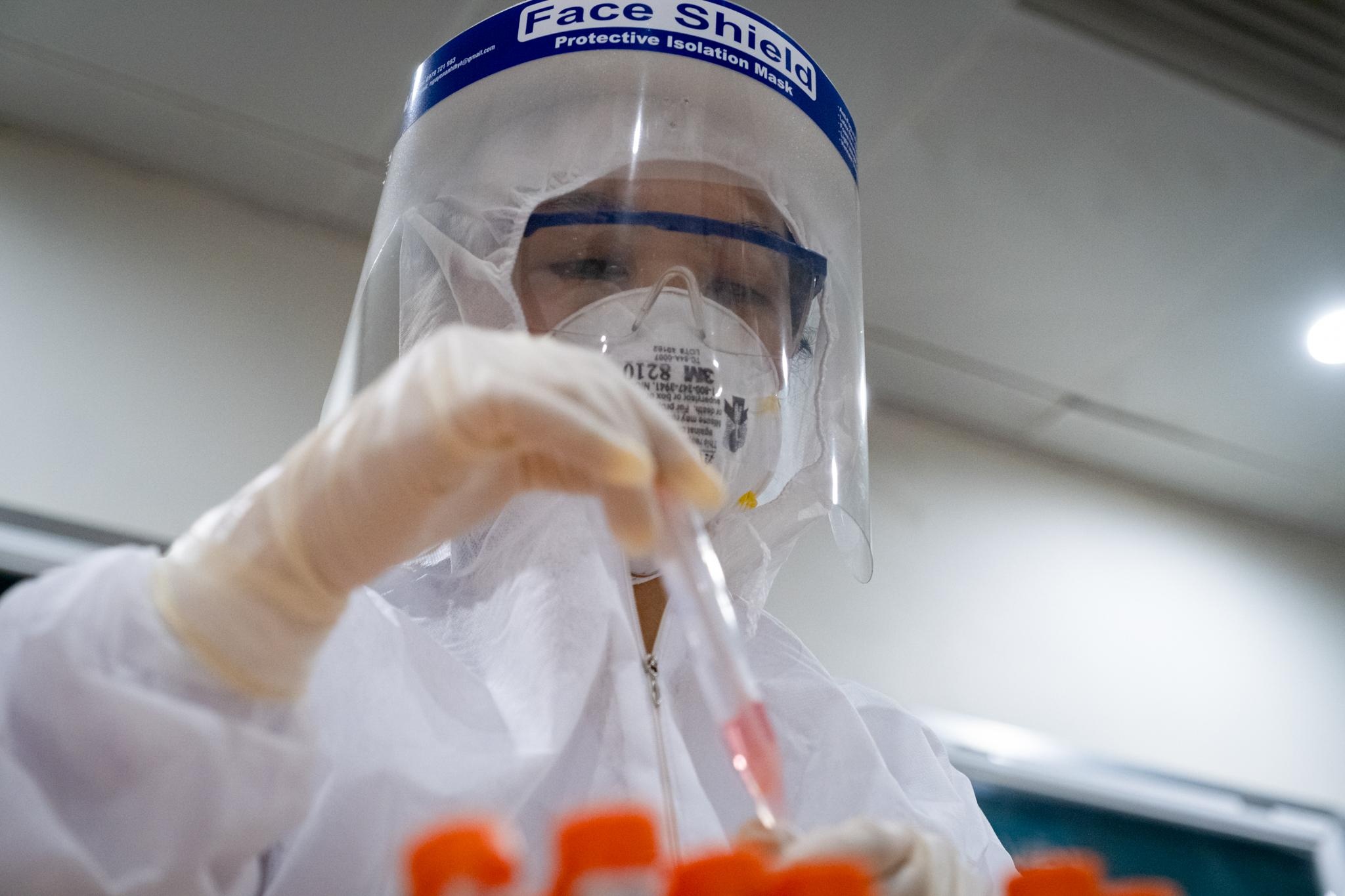 Xét nghiệm virus SARS-CoV-2 tại chỗ ảnh 1 Xet nghiem virus SARS-CoV-2 tai cho anh 1