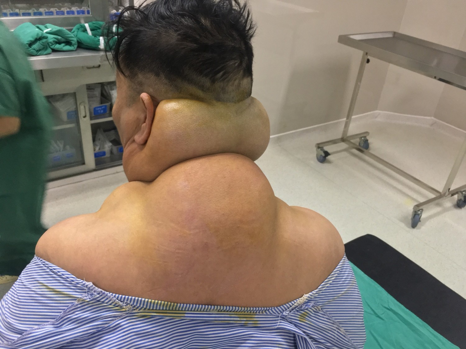 Benh nhan bien dang nhu nguoi khong lo anh 1