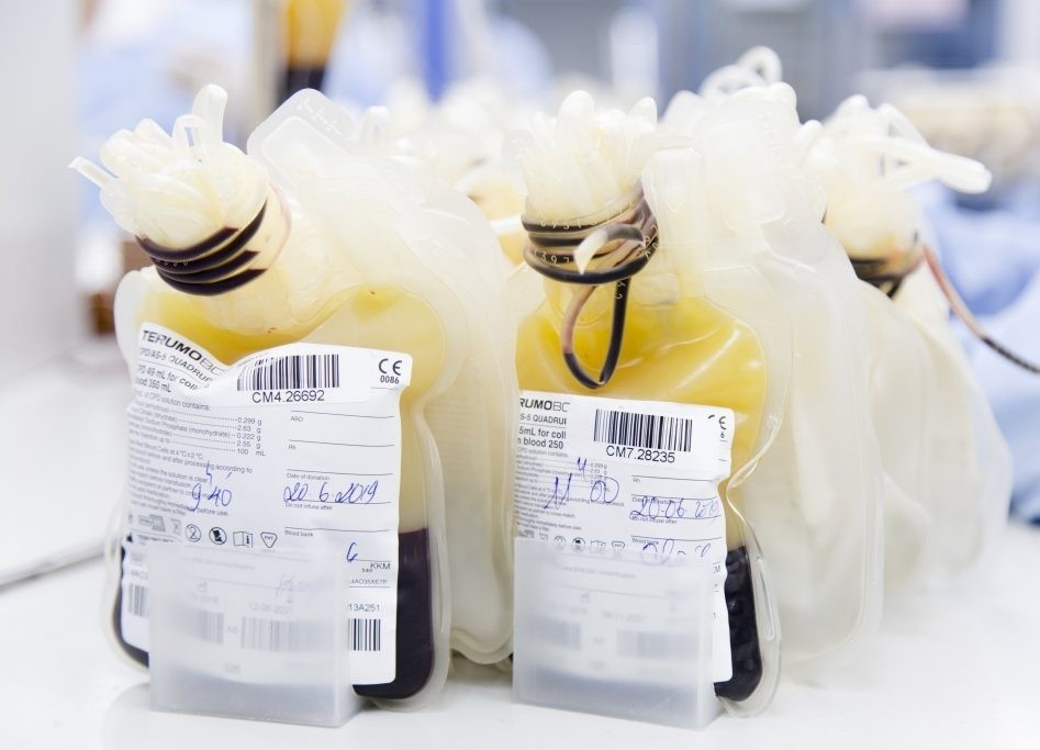 Benh nhan hon me gan duoc cuu song nho thay huyet tuong hinh anh