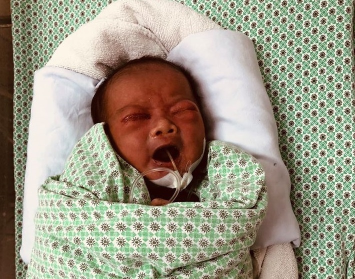 be so sinh bi bo roi anh 1