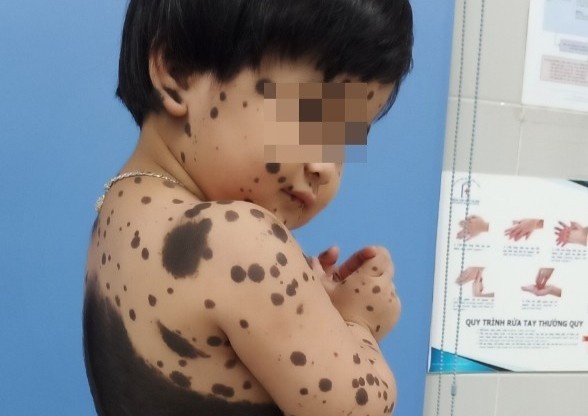 Be gai bi cham den khap co the: 'Cac ban cu treu con' hinh anh