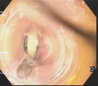 Xuong ga mac ngang thuc quan anh 1