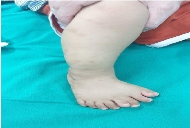 Ban chan co 9 ngon anh 1