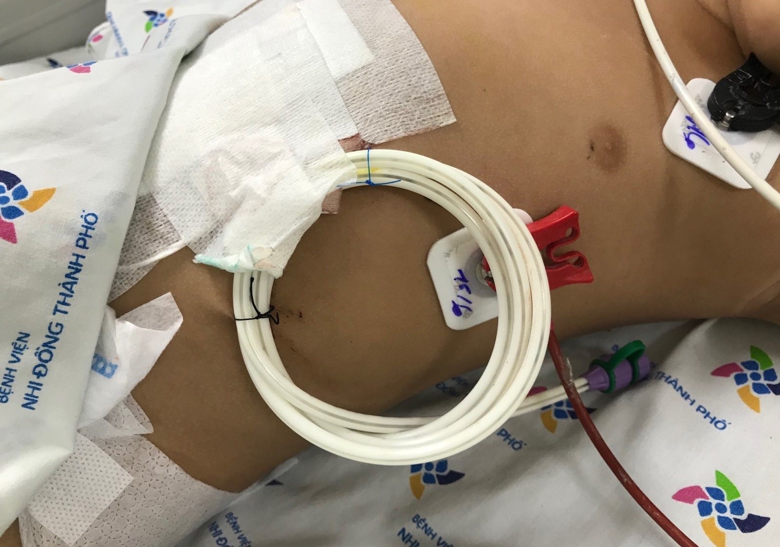 Be 2,5 tuoi uong nham hoa chat trong chai nuoc ngot hinh anh