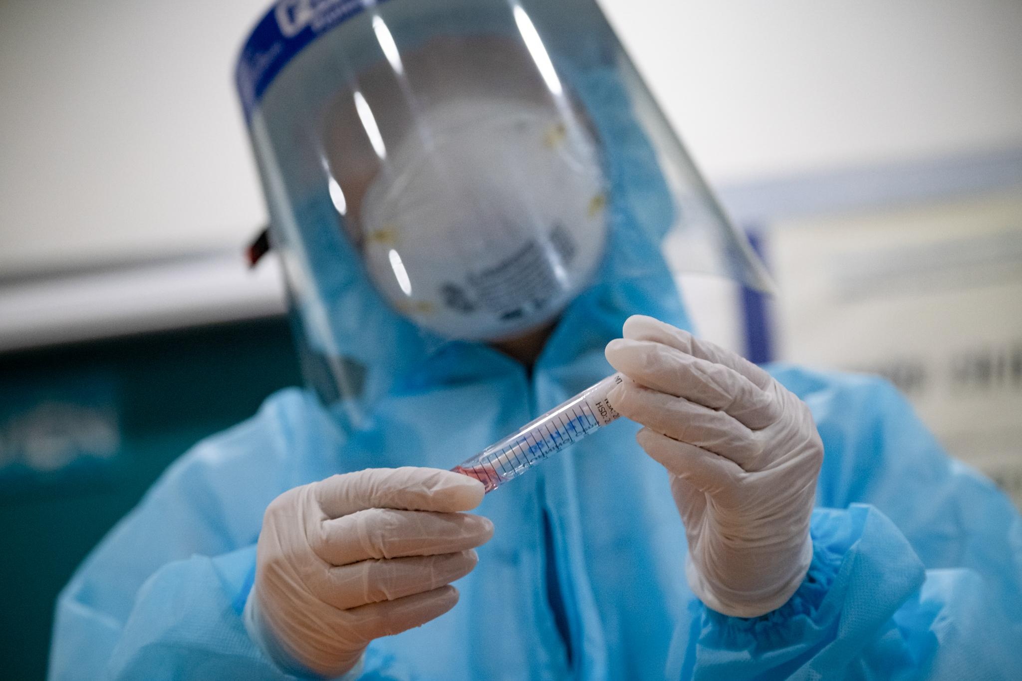 Xet nghiem Covid-19 ca tang 12 mot chung cu o TP.HCM hinh anh