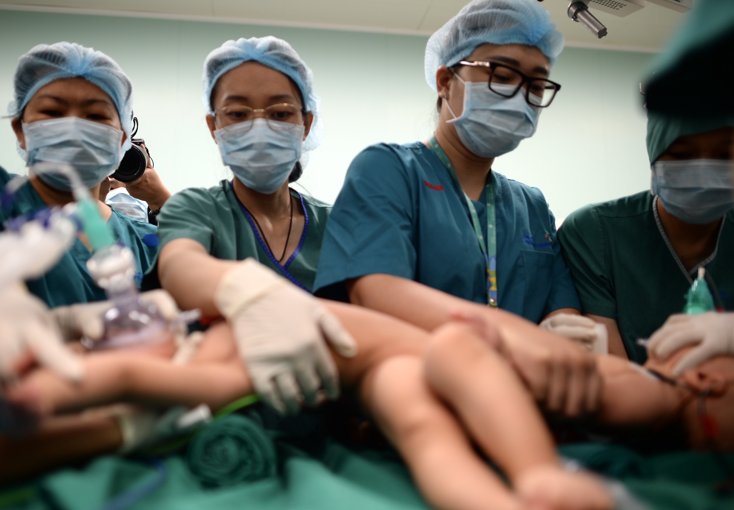 Cap song sinh dinh lien anh 1