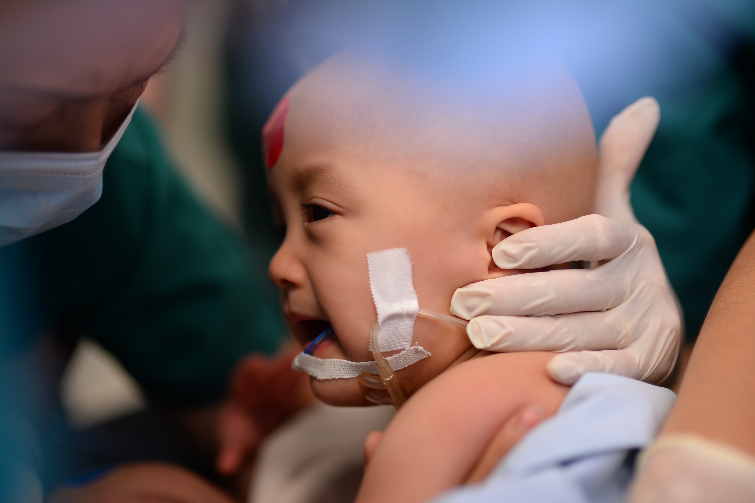 Tach cap song sinh dinh lien anh 2