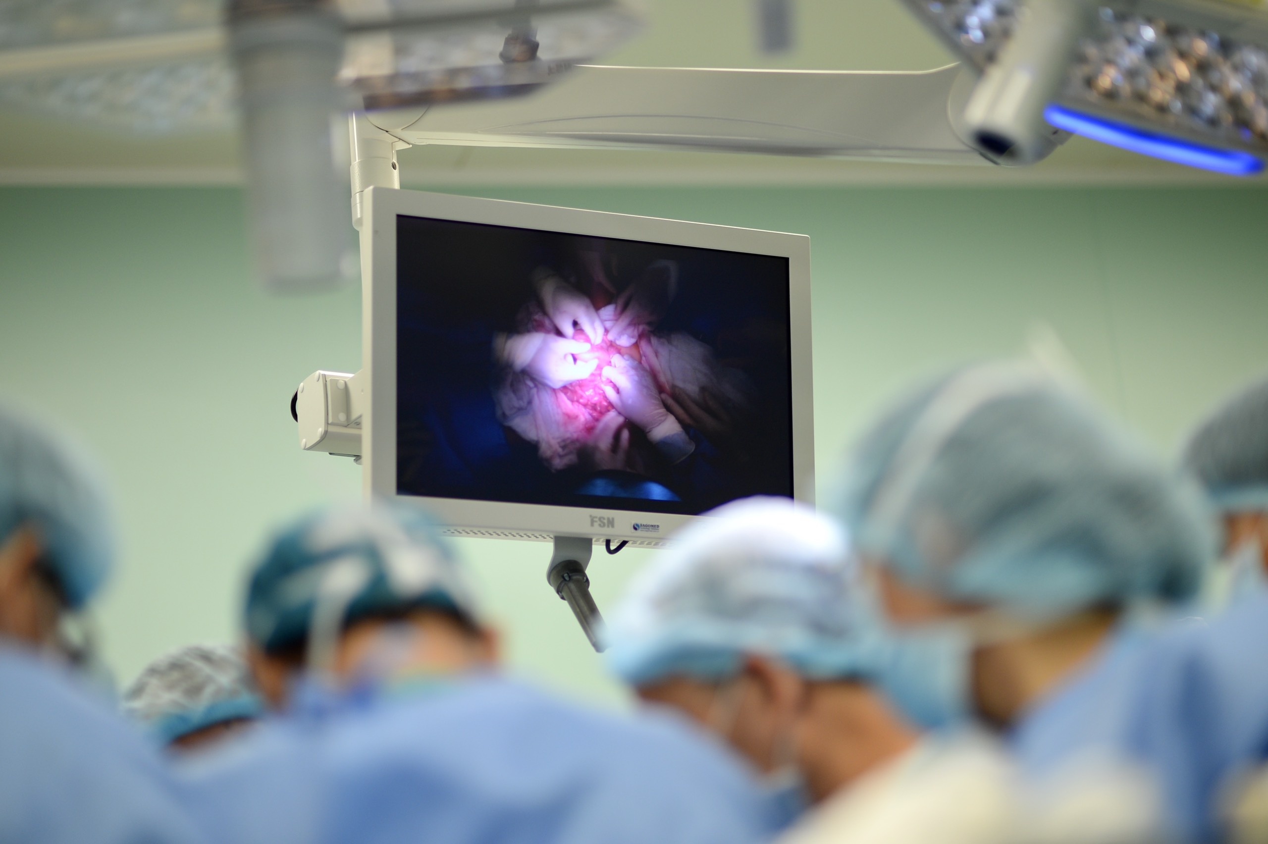 Tach cap song sinh dinh lien anh 3