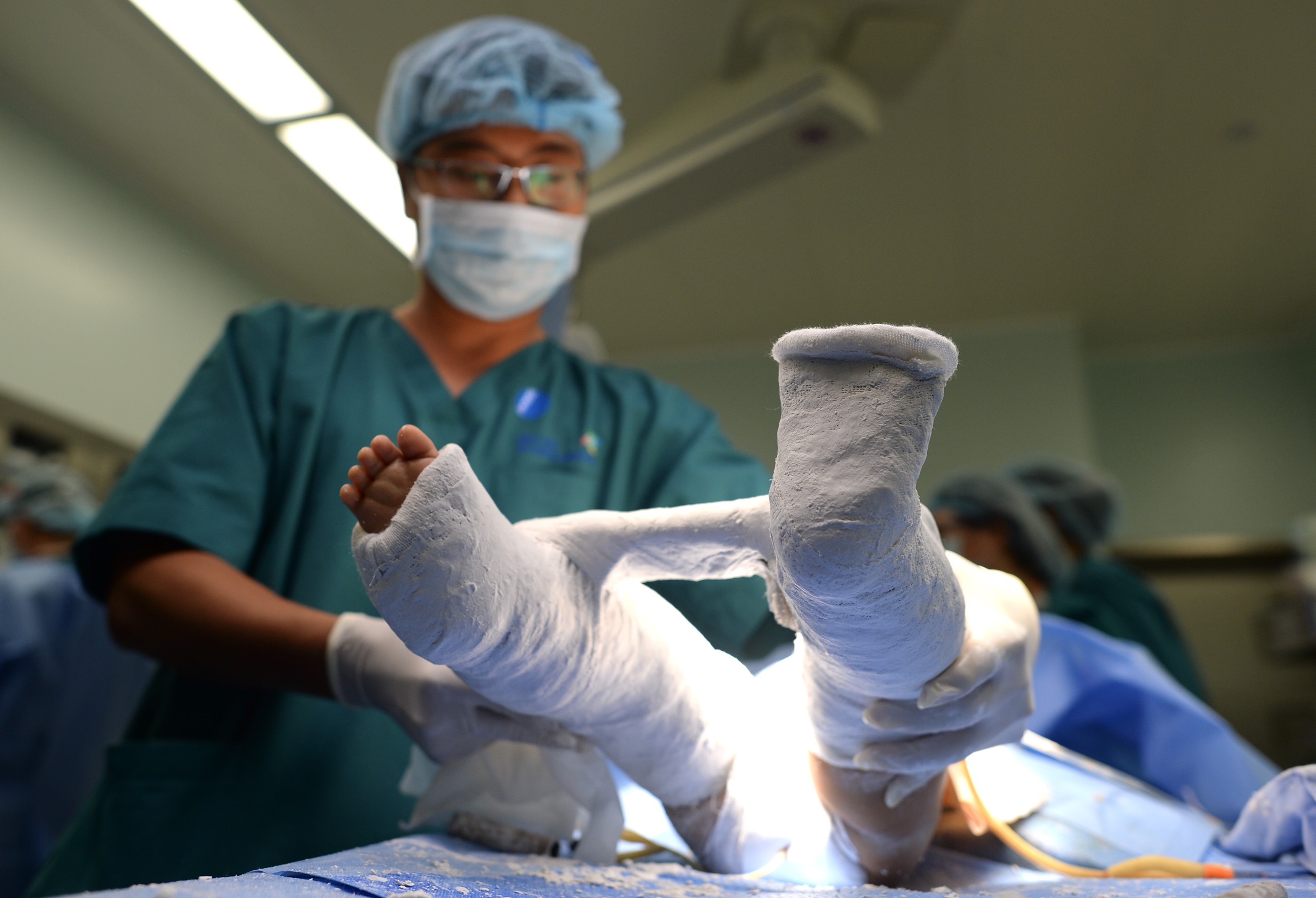 Tach cap song sinh dinh lien anh 7