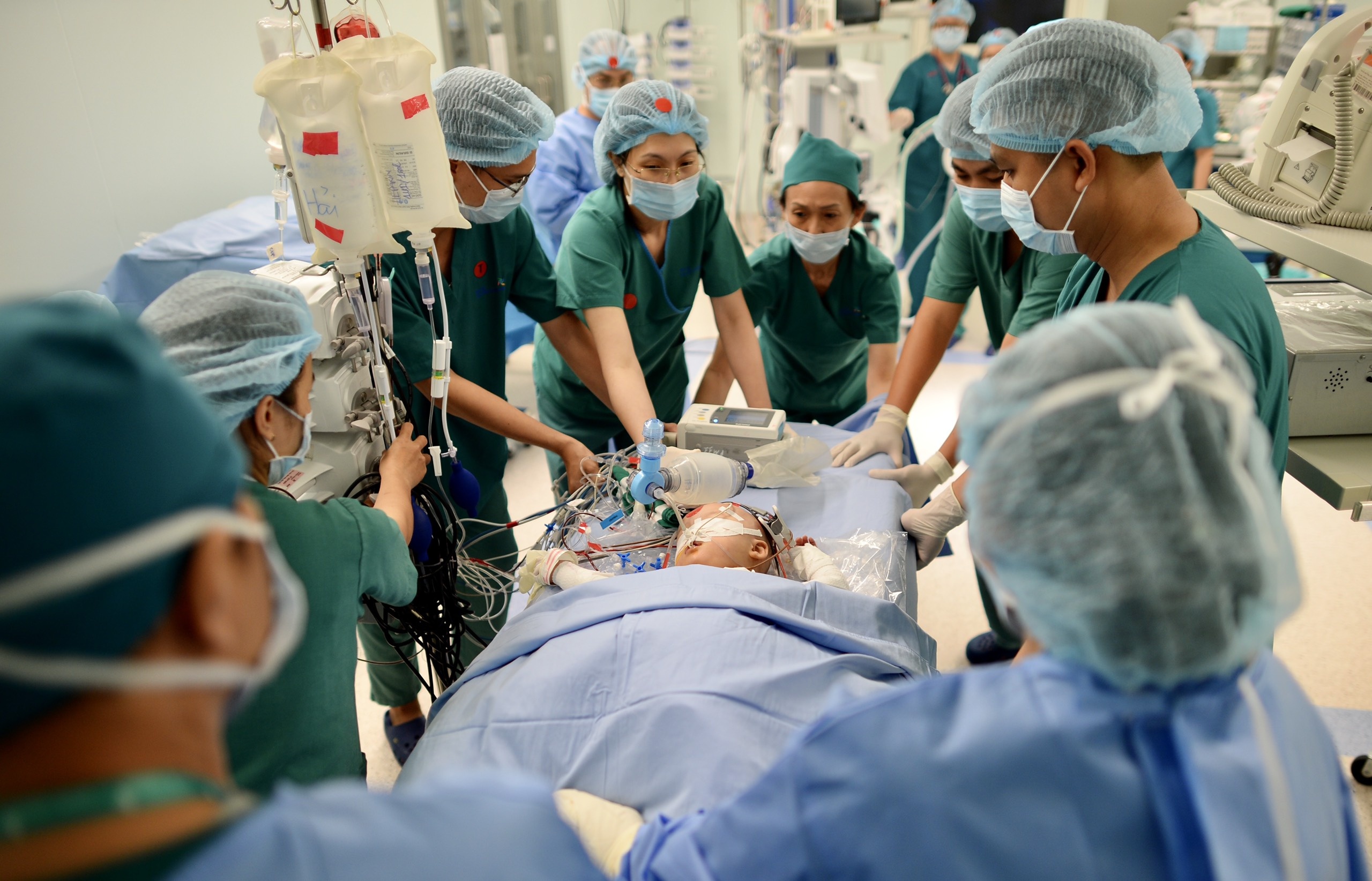 Tach cap song sinh dinh lien anh 10