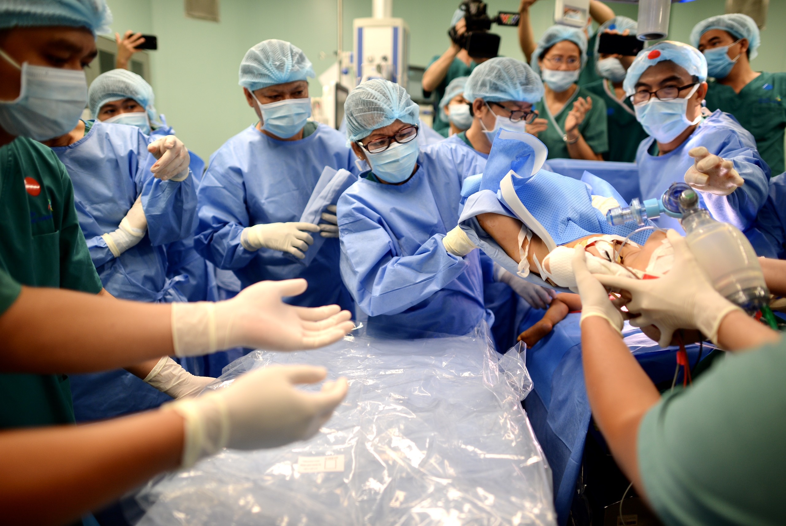 Tach cap song sinh dinh lien anh 9