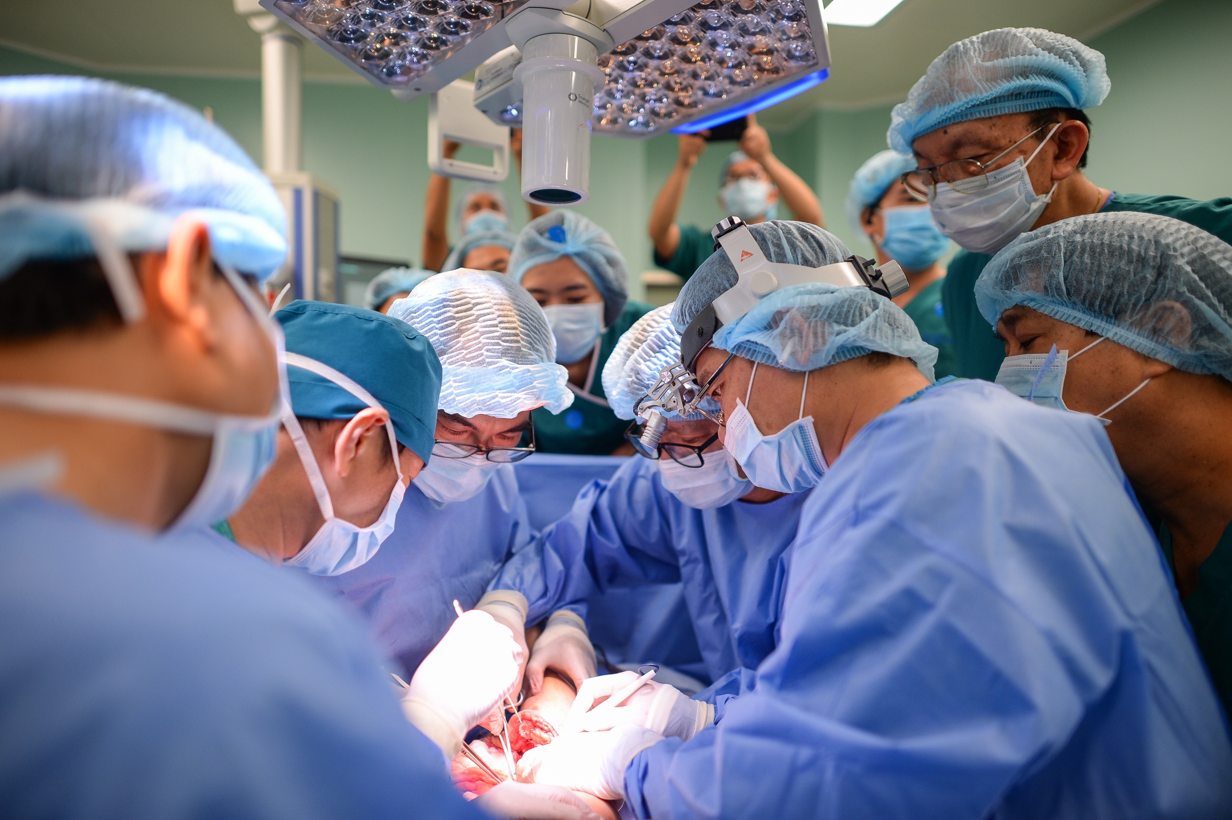 Tach cap song sinh dinh lien anh 4