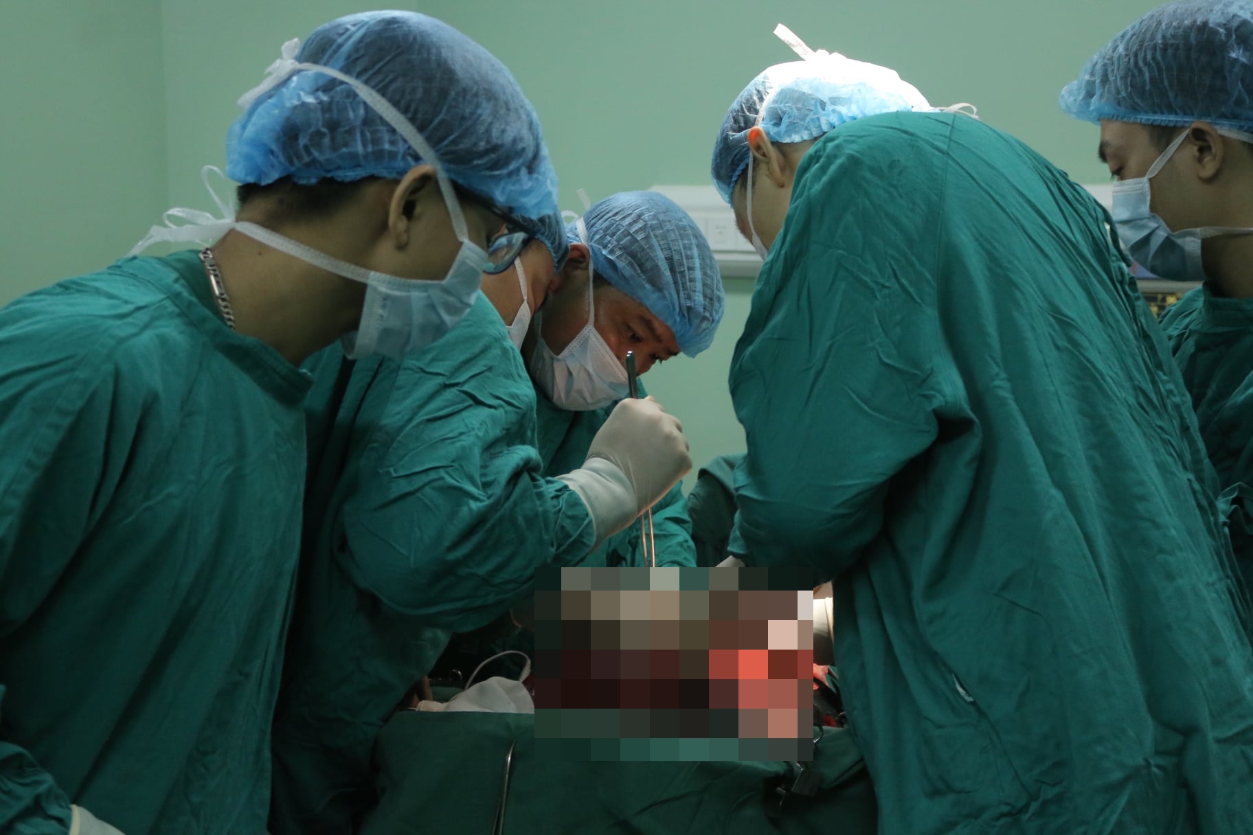 6 khối u lớn trong ổ bụng người đàn ông ảnh 1 6 khoi u lon trong o bung nguoi dan ong anh 1
