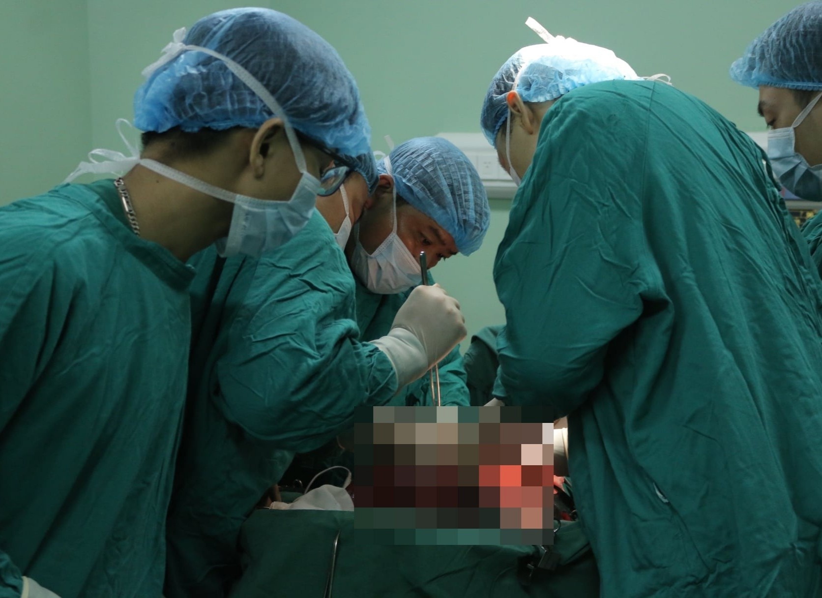 Nguoi dan ong mang 6 khoi u trong co the hinh anh