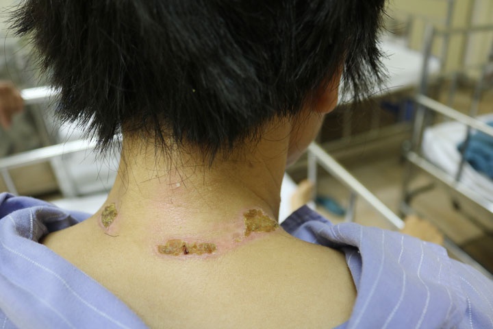 Người phụ nữ bị sét đánh ảnh 1 Nguoi phu nu bi set danh anh 1