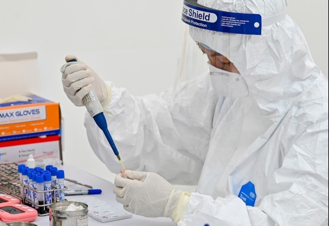 Ai khong phai tra tien khi xet nghiem Covid-19? hinh anh