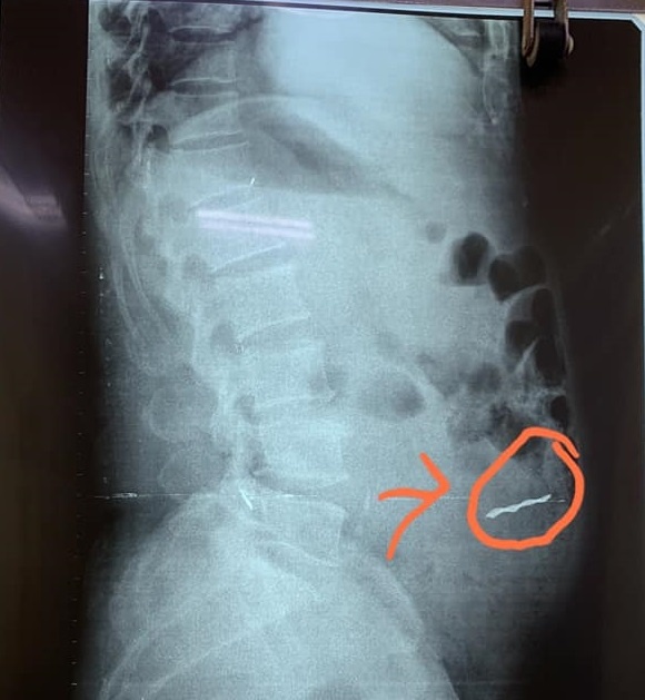 Thung ruot do may cat co anh 1