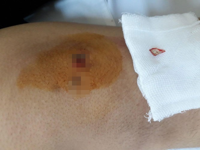Mảnh gương vỡ nằm trong đầu gối một năm ảnh 1 Manh guong vo nam trong dau goi mot nam anh 1