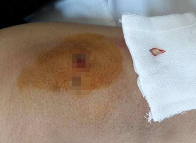 Manh guong nam trong dau goi suot mot nam hinh anh