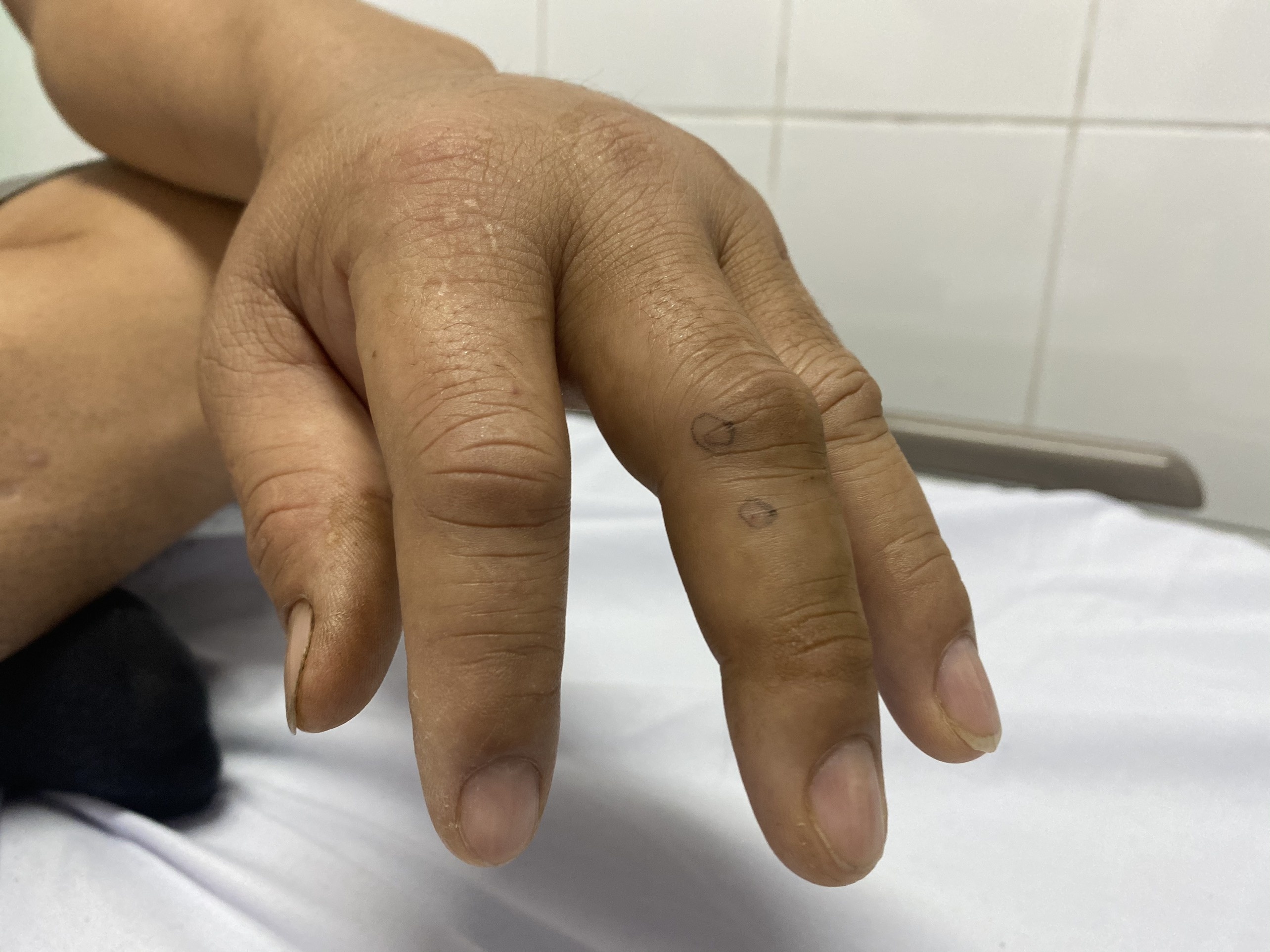 Nguoi dan ong bi ran luc duoi do can anh 1