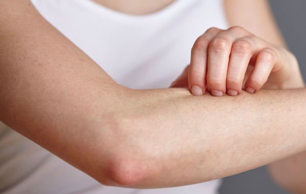 Benh do kien ba khoang anh 5