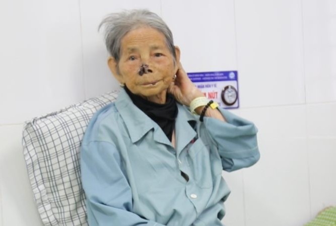 Cuu benh nhan 103 tuoi bi nhoi mau co tim hinh anh