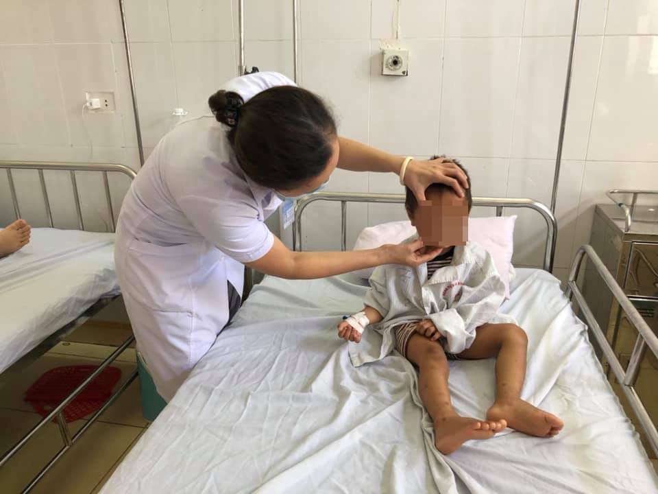Dây thun bắn vào mắt ảnh 1 Day thun ban vao mat anh 1