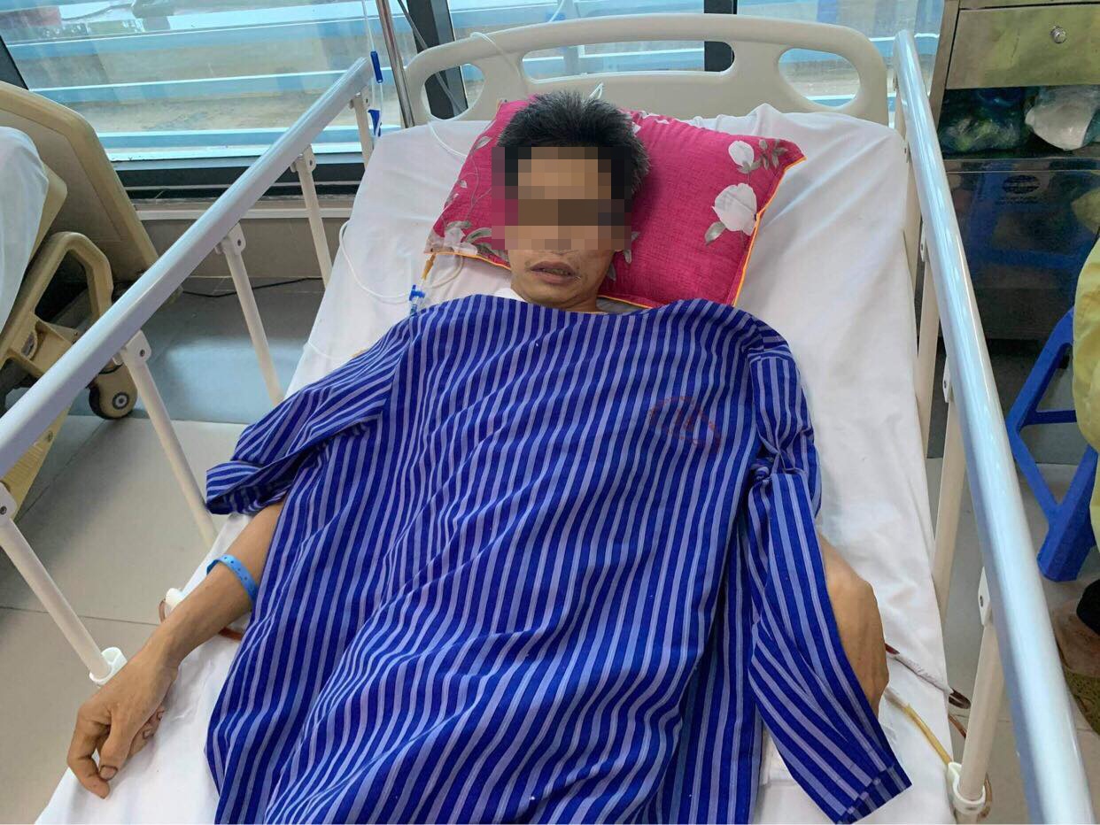 Người đàn ông ngã cây cao 10 m ảnh 1 Nguoi dan ong nga cay cao 10 m anh 1