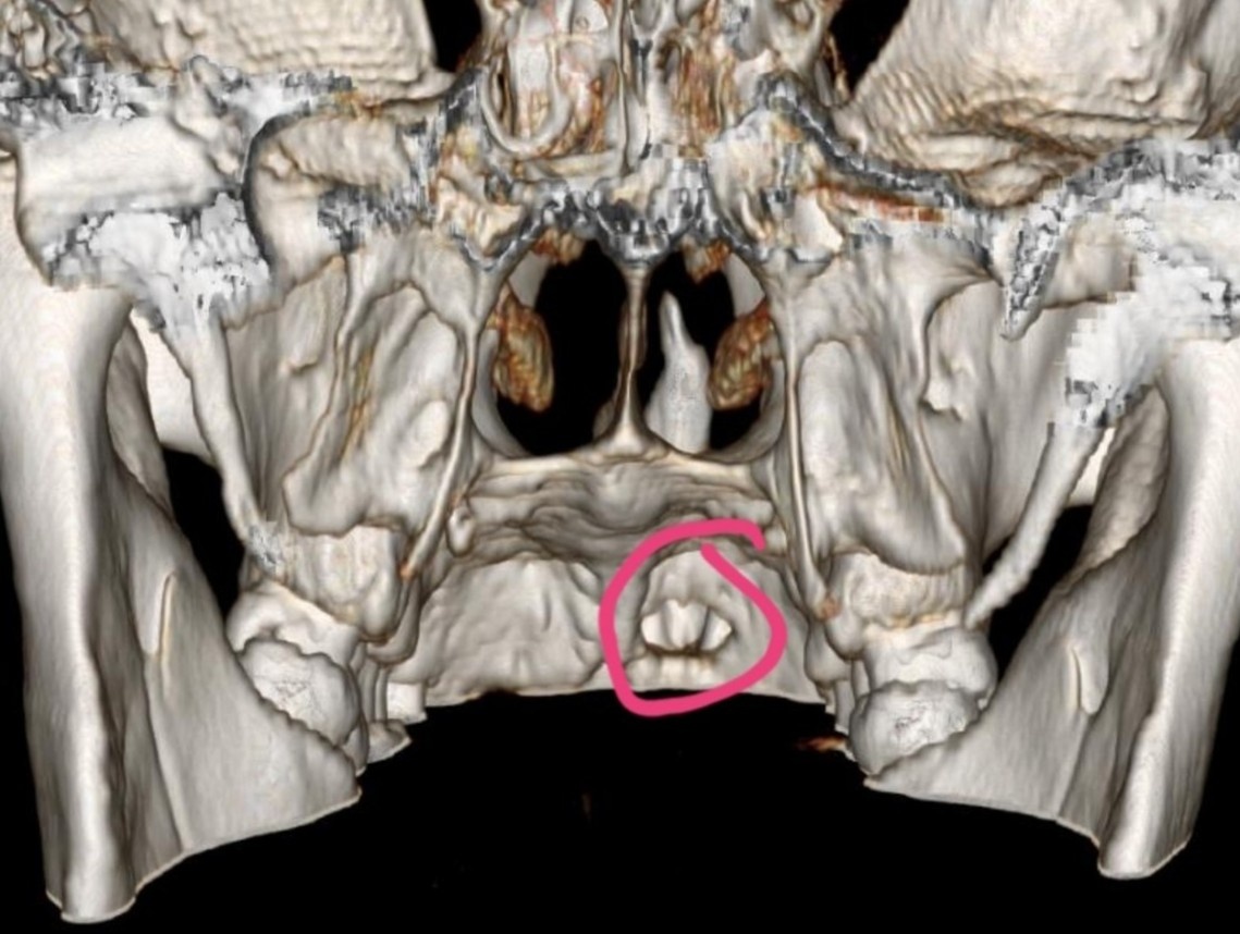 Rang moc ngam choc thung hoc mui hinh anh