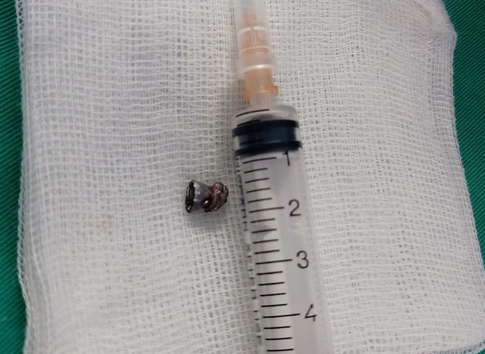 Nguoi dan ong bi dan chi ban xuyen co hinh anh